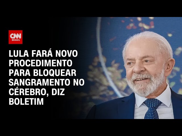 Lula fará novo procedimento para bloquear sangramento no cérebro, diz boletim | CNN 360º